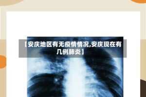 【安庆地区有无疫情情况,安庆现在有几例肺炎】