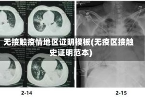 无接触疫情地区证明模板(无疫区接触史证明范本)