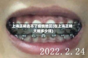 上海正畸去不了疫情地区(在上海正畸大概多少钱)