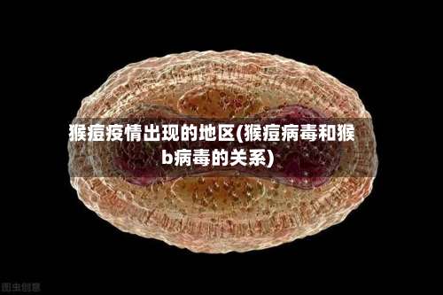 猴痘疫情出现的地区(猴痘病毒和猴b病毒的关系)-第1张图片