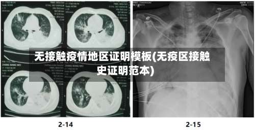 无接触疫情地区证明模板(无疫区接触史证明范本)-第1张图片