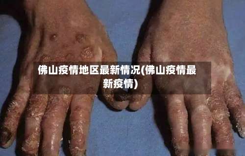 佛山疫情地区最新情况(佛山疫情最新疫情)-第2张图片