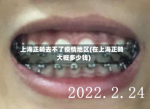 上海正畸去不了疫情地区(在上海正畸大概多少钱)-第1张图片